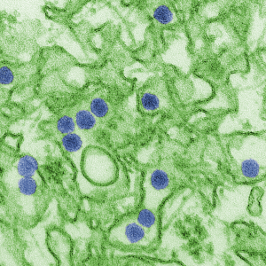 Zika Virus Infection