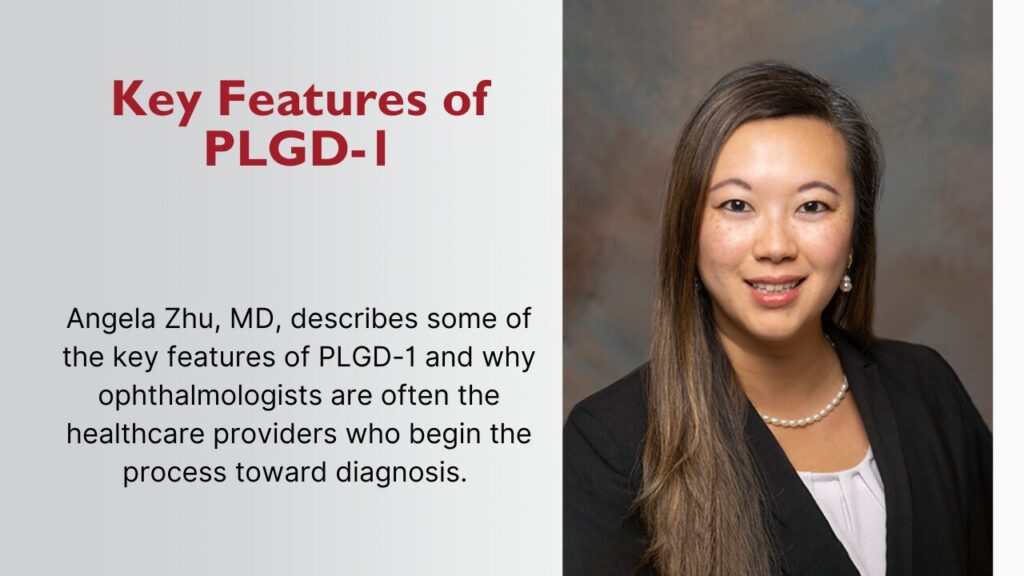 Key Features of PLGD-1