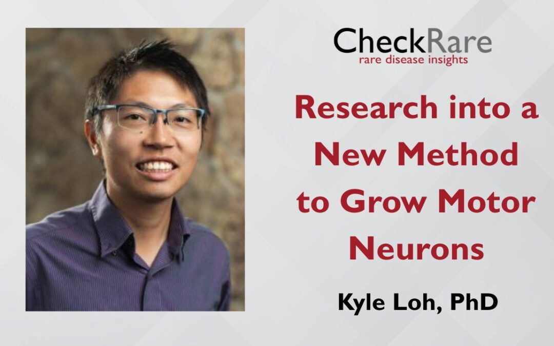 New Stem Cell Method Could Advance Research Into Spinal Muscular Atrophy